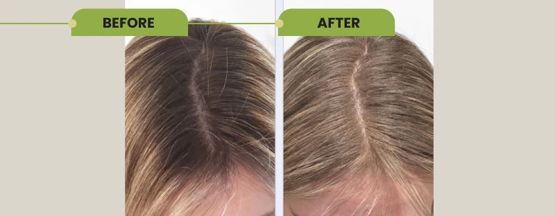 Hair Color Trend Taking Over 2025